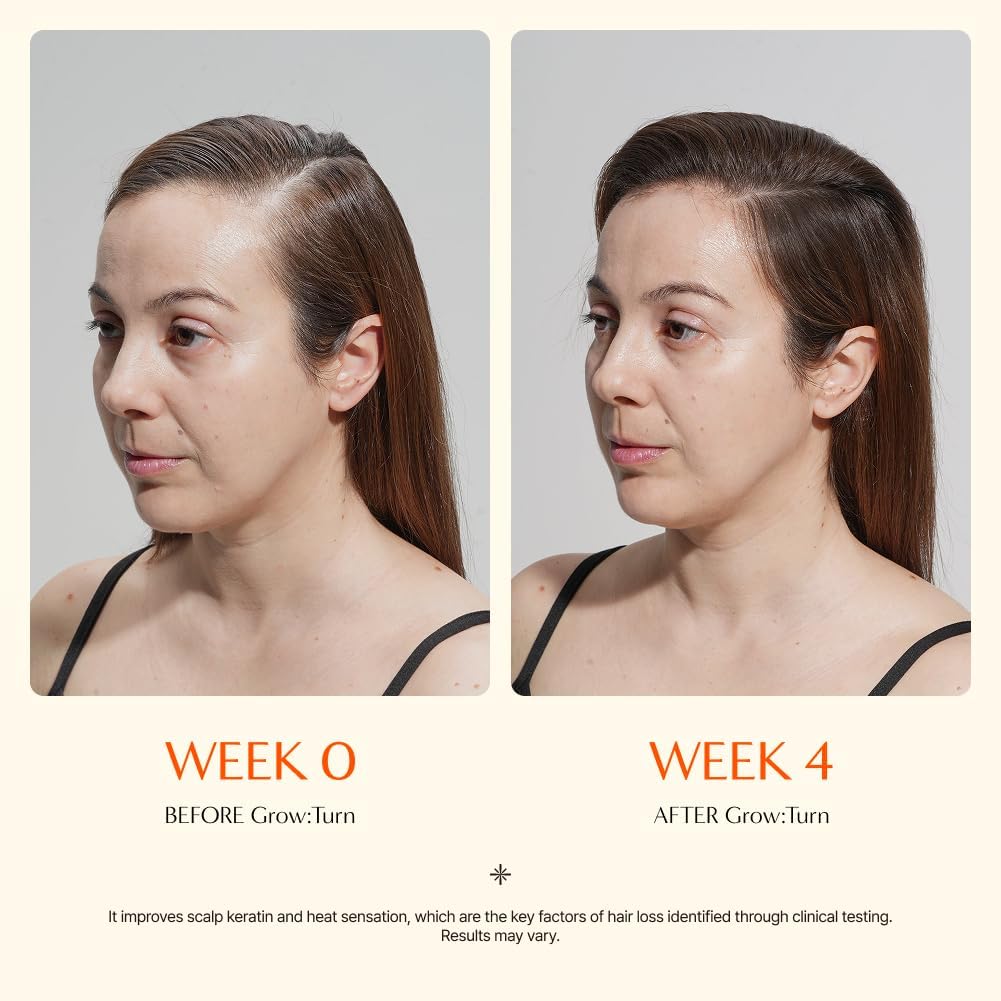 Growturn Hair Growth Serum with Built in Brush for Hair Growth & Thickening | Treatment for Thinning Hair, Hair Loss | Low Irritation, Fragrance-Free, Sulfate & Paraben-Free, 3.38 fl. oz. (Pack of 2)