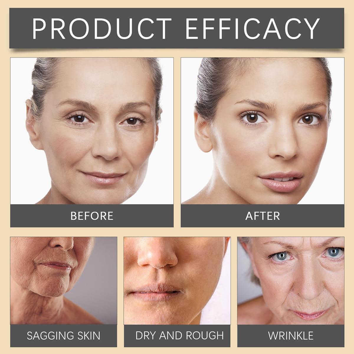 Bee Venom Moisturiser Cream Wrinkle Removal & Firming, Anti-Aging Eye&Face Bee Venom Skin Treatment Cream, Natural And Non-Irritating, Lifting & Recovery For All Skin Type (2 Packs, 20g)