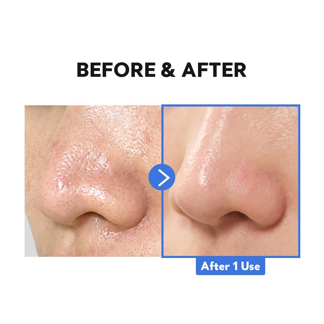 TIRTIR Hydro Boost Enzyme Cleansing Balm (1.69 Ounce (Pack of 1))