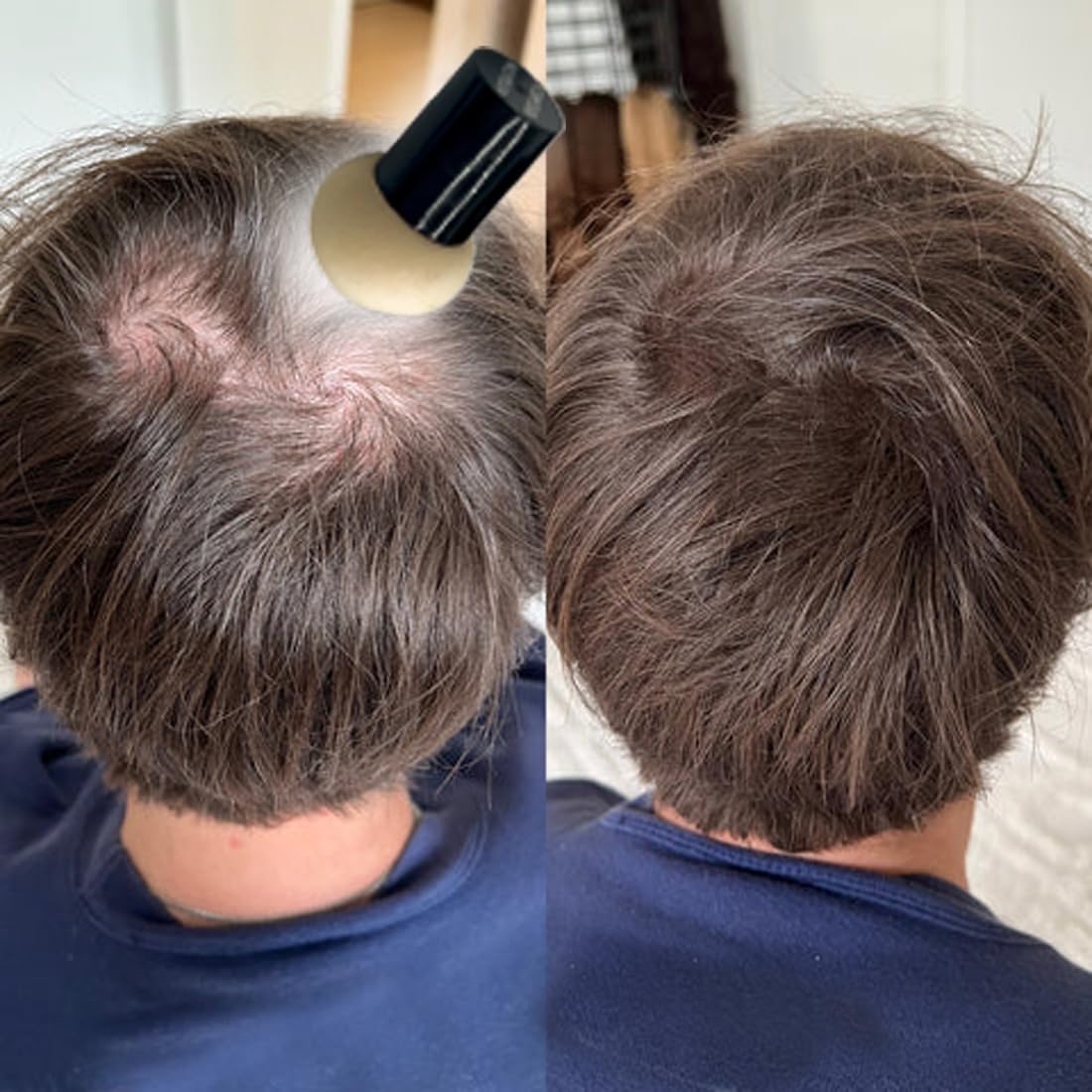 KERATIN RESEARCH Hairline Filler Unisex Mineral Powder Root Touch-Up Hair loss Concealer Scalp & Beard Bald Patch Coverage Fibers for Thinning Hair Waterproof Organic Natural look (DARK BLONDE, XL)