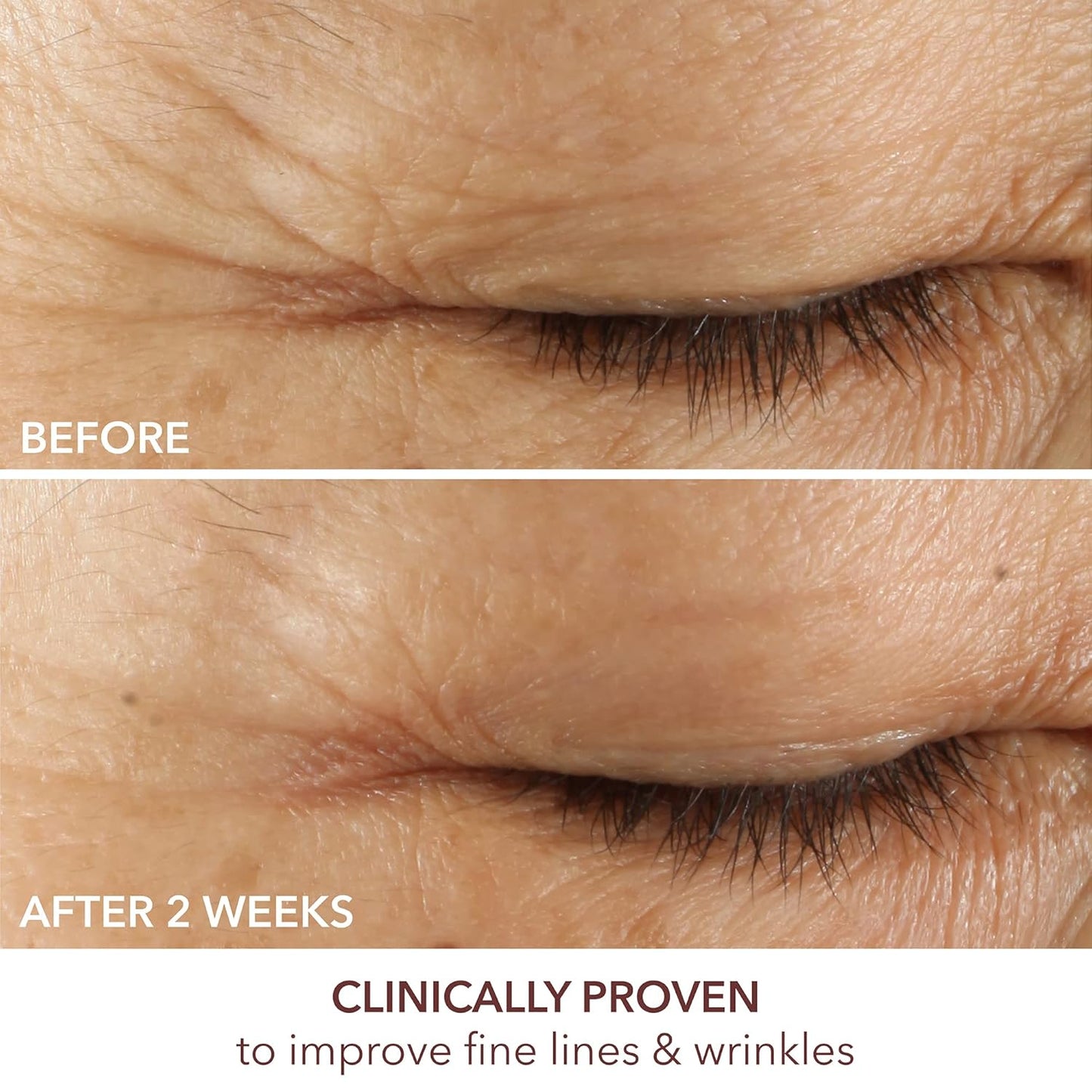 Dr. Dennis Gross Advanced Retinol + Ferulic Triple Correction Eye Serum | Firm Skin, Boost Hydration, and Reduce the Look of Wrinkles & Crepiness | 0.5 oz