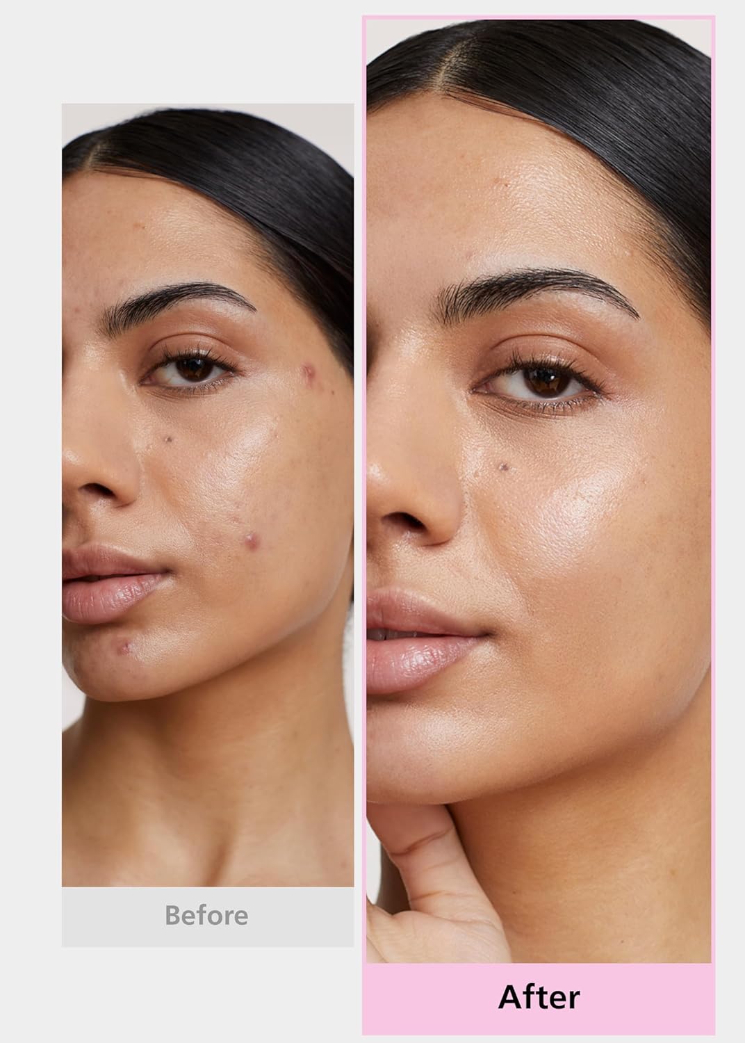 Daewoong Pharmaceutical Easyderm patch gift set