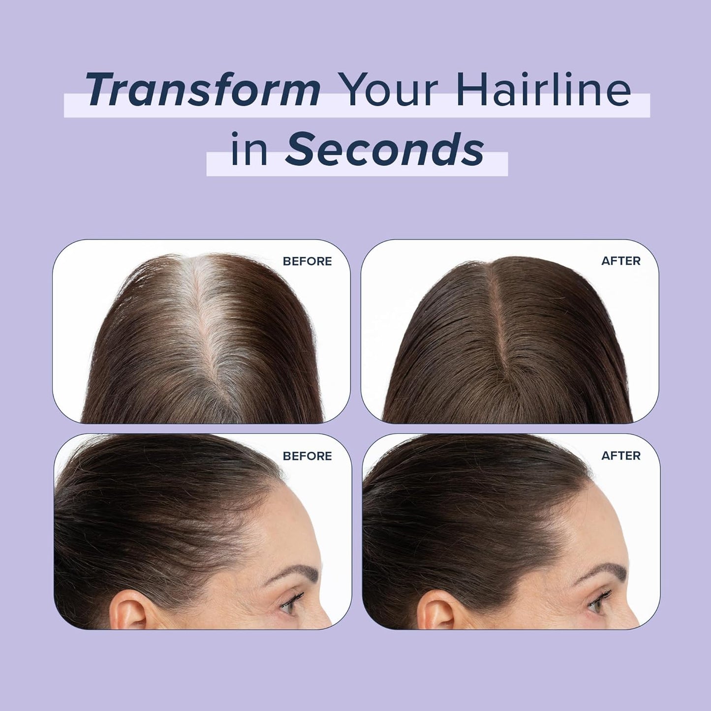 TRUHAIR Root & Scalp Cover Up Refill, Waterproof Pressed Powder for Gray Coverage, Bald Spots & Thinning Hair, Root Touch Up Color, 0.35 oz (Dark Brown)