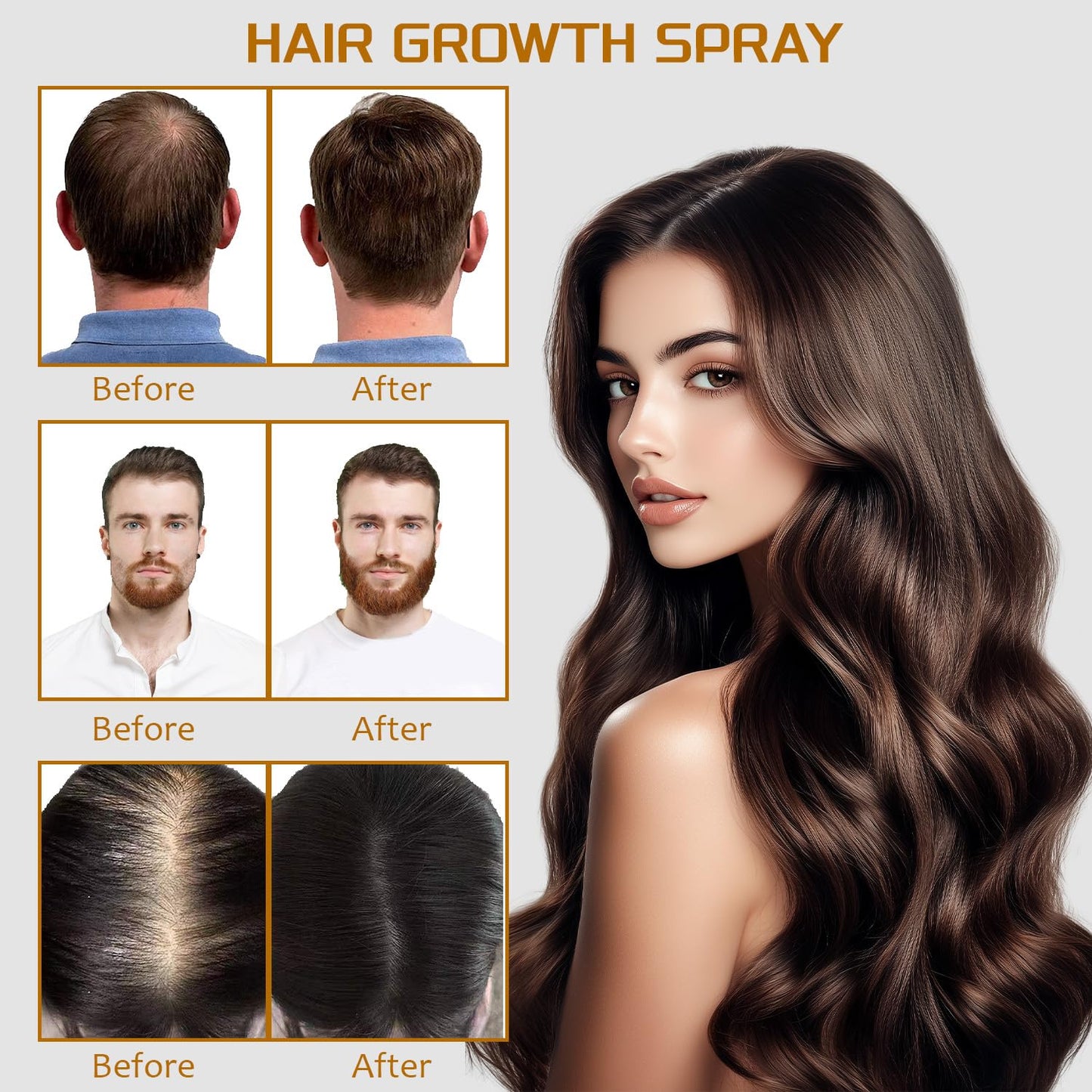 100ml 5% Minoxidil Spray with Biotin - Regrowth Treatment for Men & Women, Promotes Thicker, Stronger, Fuller Hair, Prevents Hair Loss, Minoxidil for Men Hair & Beard, Minoxidil for Women Hair Growth