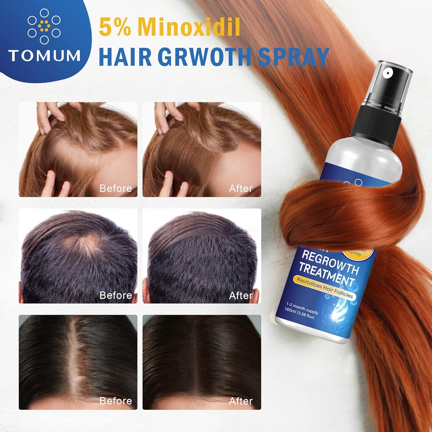 Minoxidil for Men and Women Hair Growth: 5% Minoxidil Spray Hair Regrowth Treatment Serum Stop Hair Thinning and Hair Loss For Stronger Thicker Longer Hair 100ml