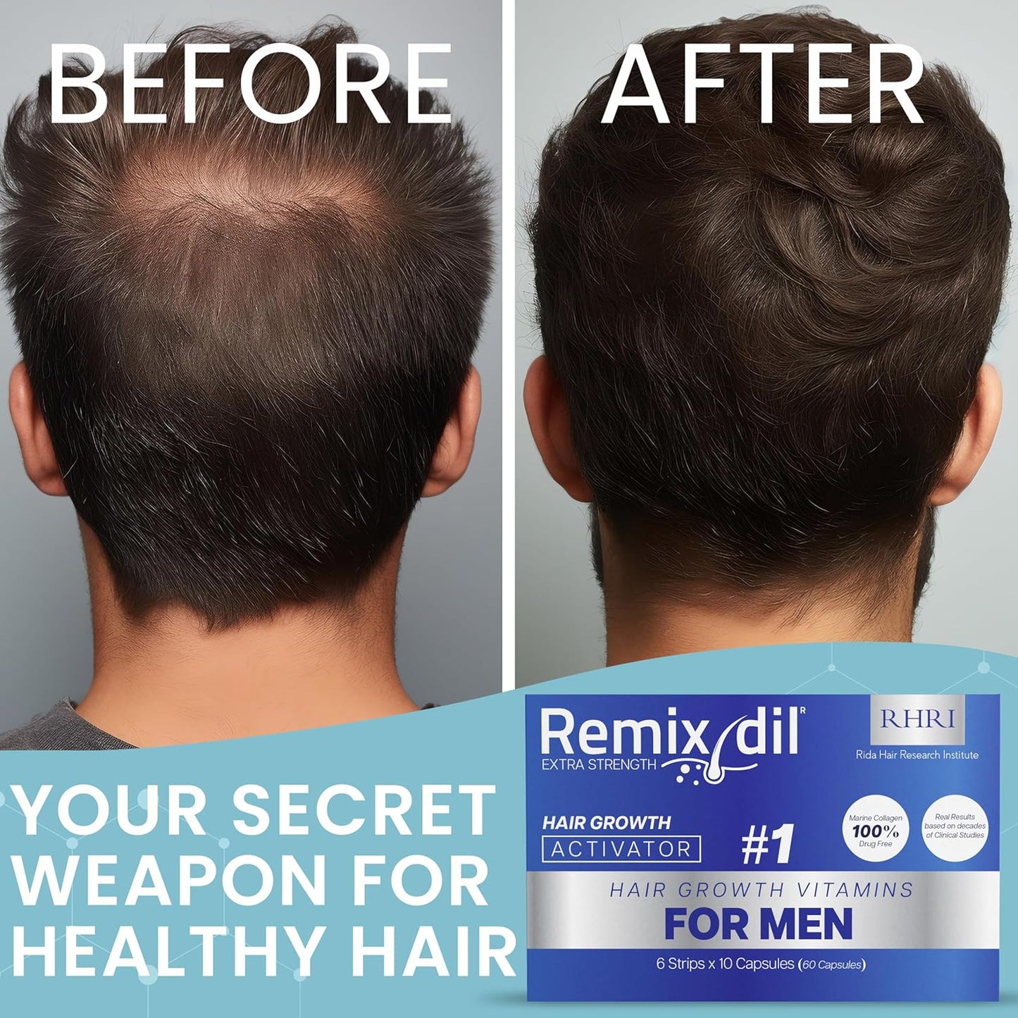 Hair Growth Vitamins Hair Regrowth For Men | Supports Beard And Scalp Strength | Helps Reduce Thinning And Breakage | Fast-Acting Formula To Boost Volume | 60 Capsules